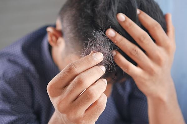 Препарат от артрита помогает при выпадении волос: почему и как